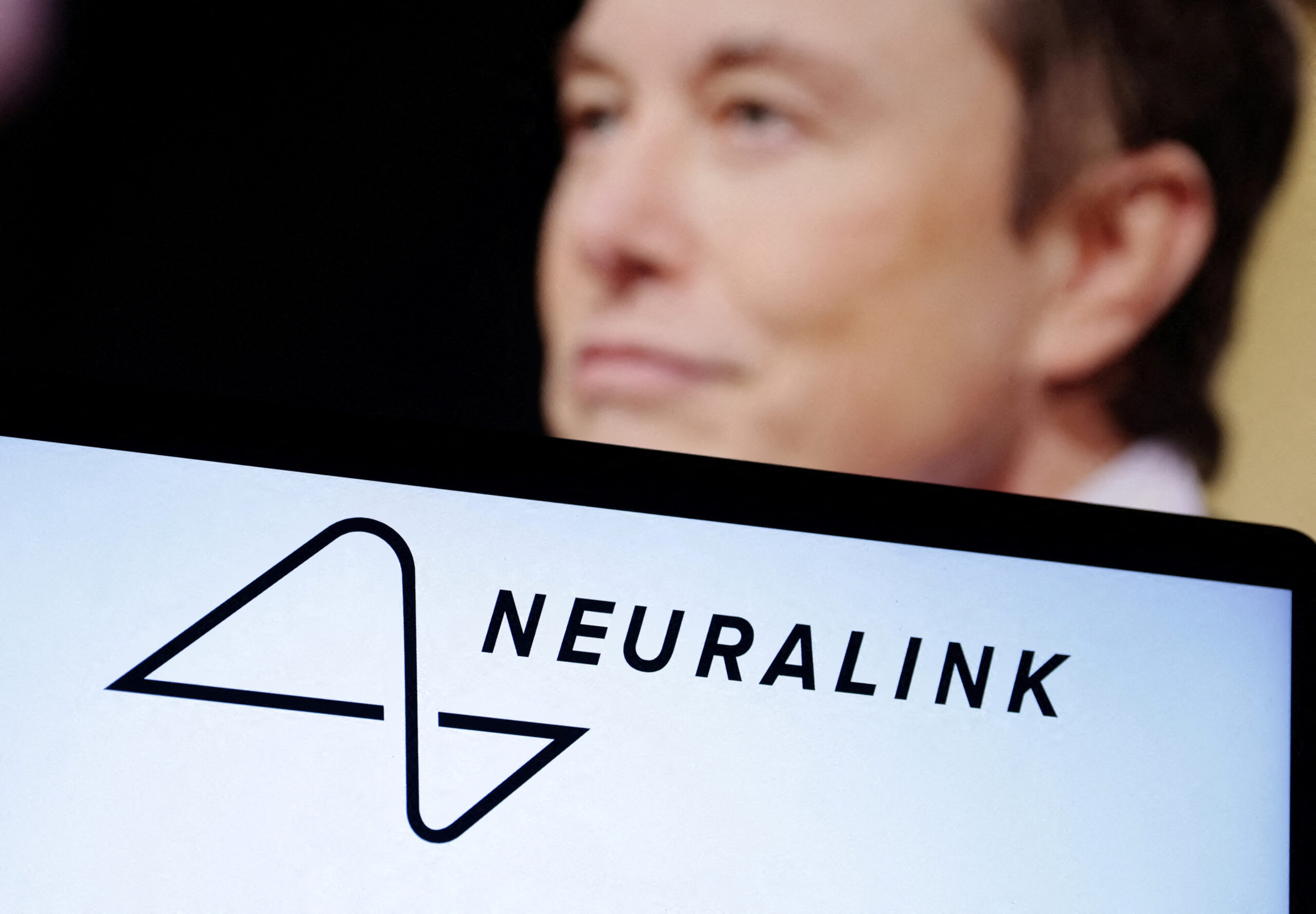 Neuralink’s Human Neural Implant Studies: Revolutionizing Brain Science